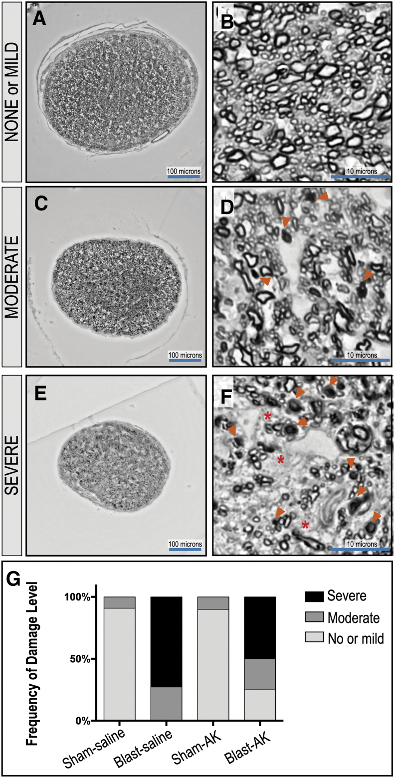 FIG. 11.