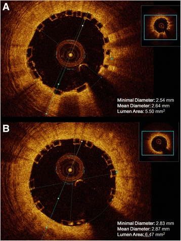 Fig. 4