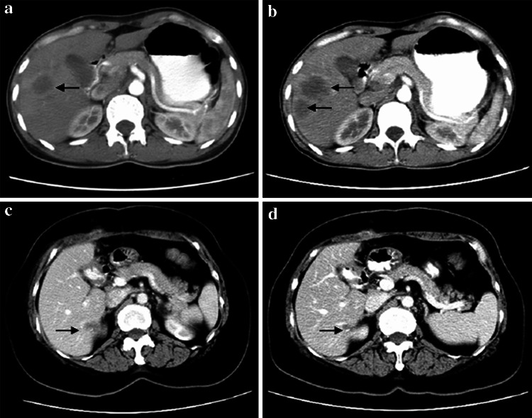 Fig. 1