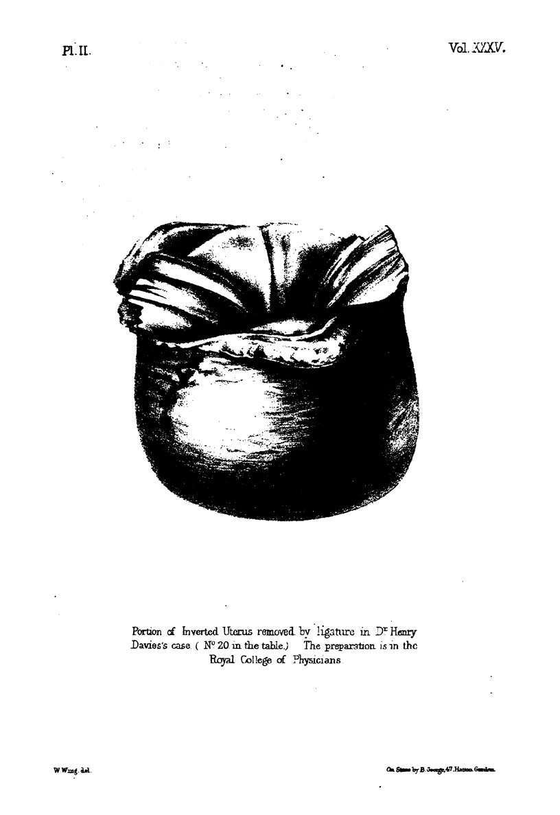 152-3
