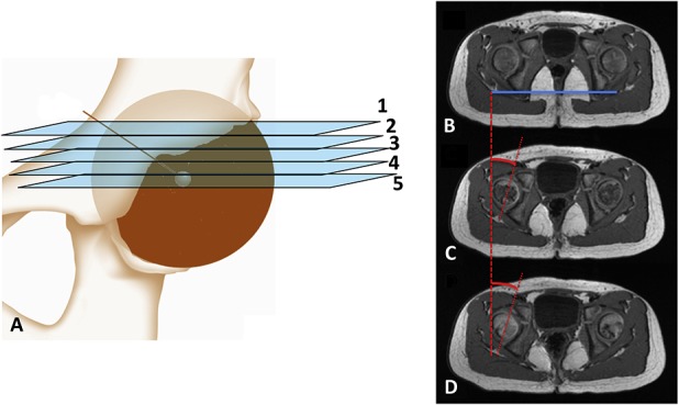 Fig. 1 A-D