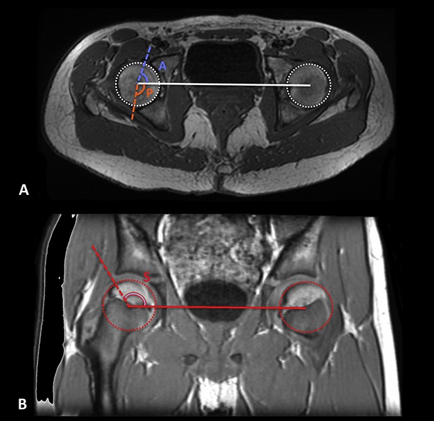 Fig. 2 A-B