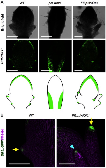 Figure 3. DR5::GFP fluorescent pattern in prs wox1 and the FILp::WOX1 plants. (A) Confocal laser scanning microscope images of developing leaves. The bottom columns show the leaf shape and the GFP pattern in the individual lines. (B) The GFP spots on a growing tip. The arrows indicate the marginal tip, and the arrow head indicates an abnormal abaxial tip. Scale bars, 200 µm (A), 100 µm (B).