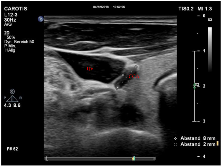 Figure 2