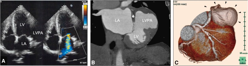 Figure 3