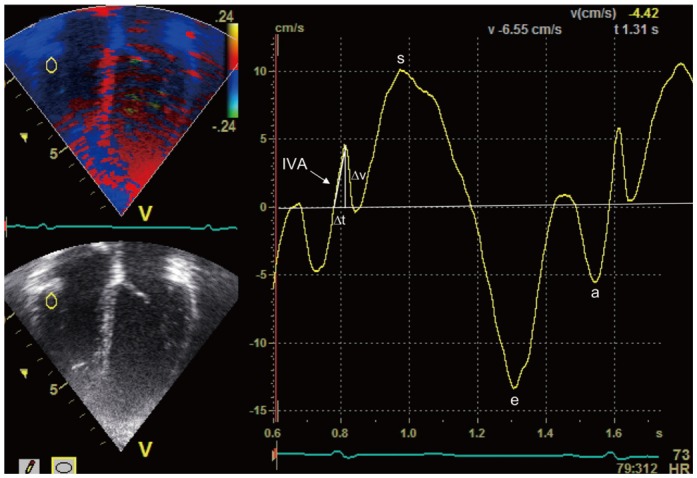 Fig. 3