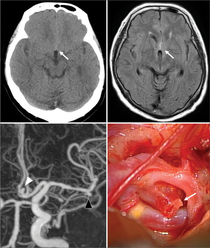 Figure 3: