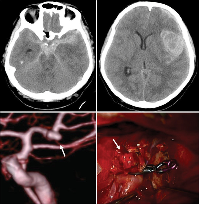 Figure 1: