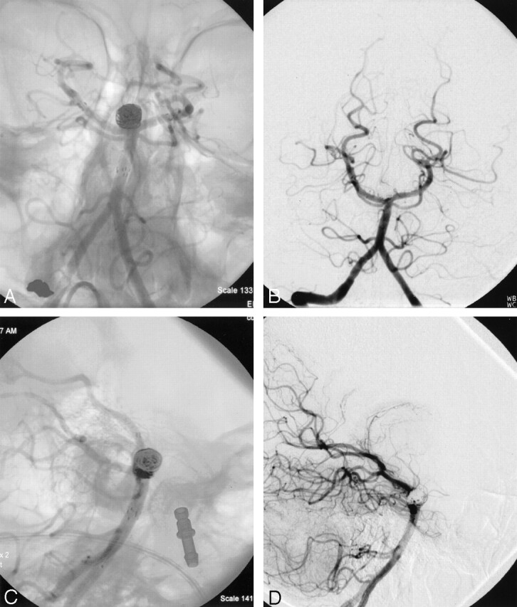 Fig 5.