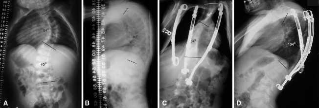 Fig. 2A–D