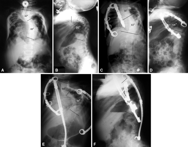 Fig. 1A–F