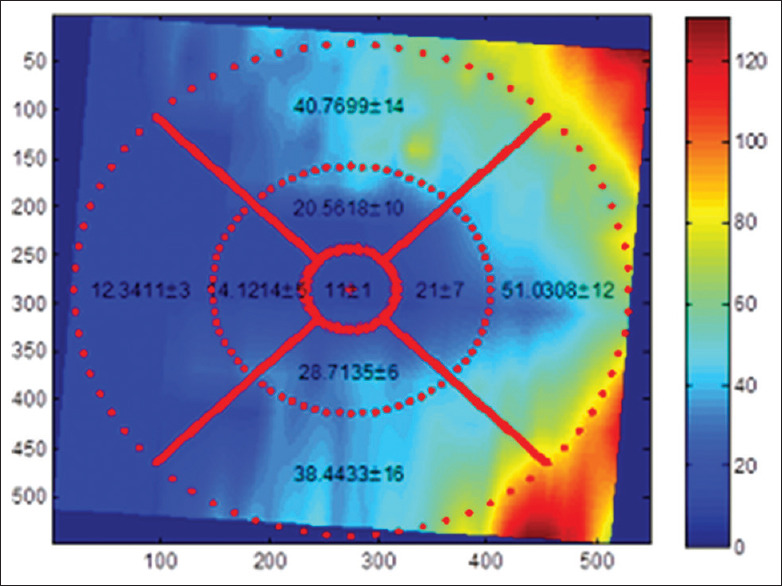 Figure 13