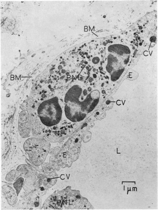 Fig 11