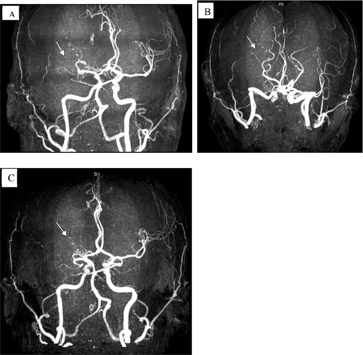 Fig 4