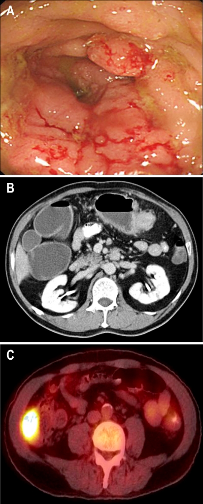 Fig. 1