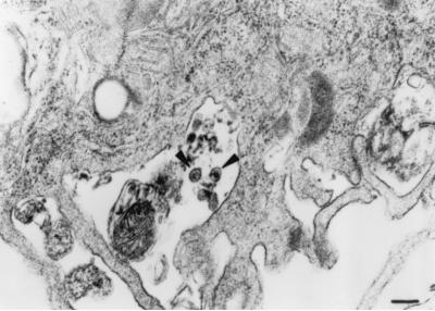 FIG. 6