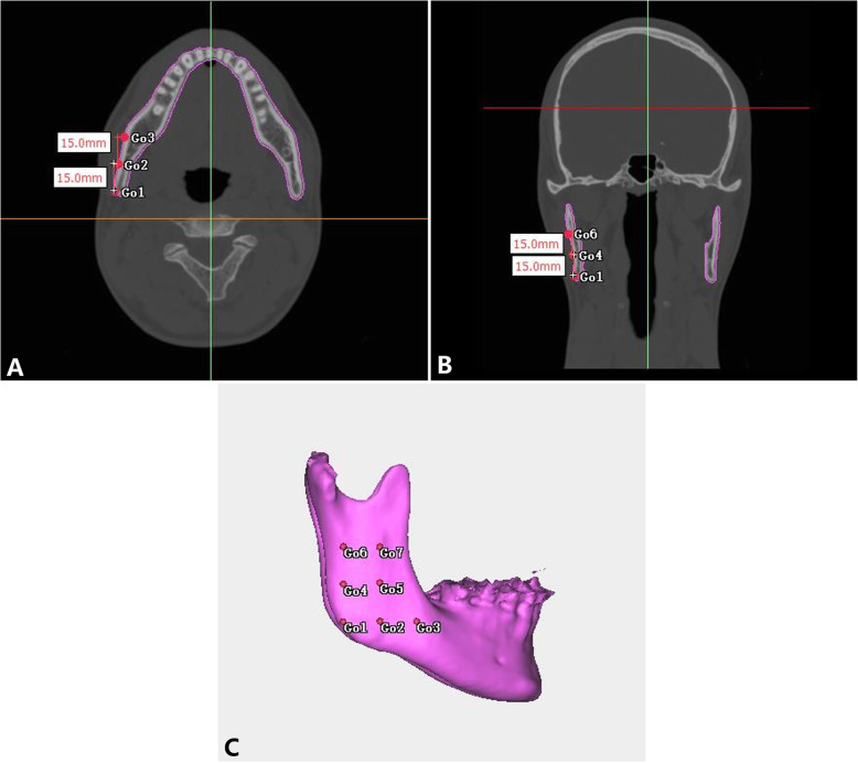 Fig. 1