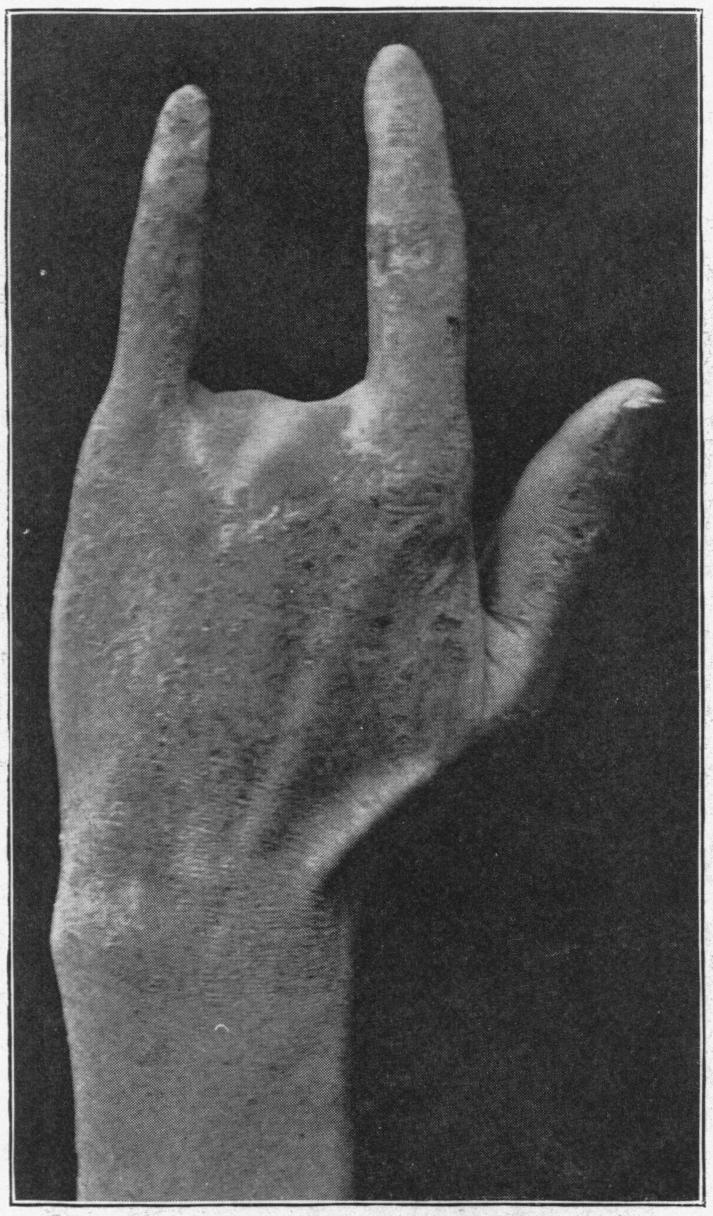 FIG. 5.