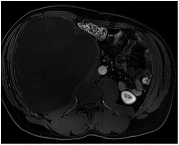 Figure 2