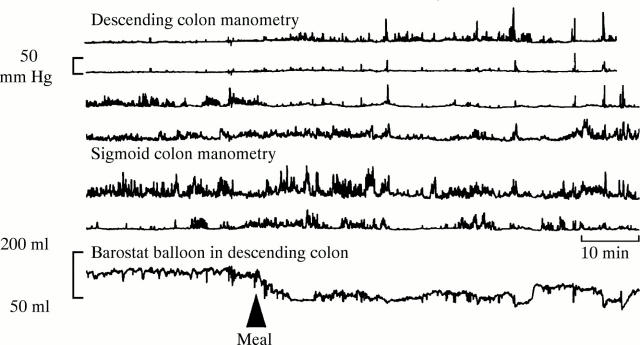 Figure 3  