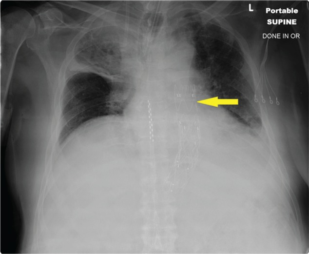 Figure 4.