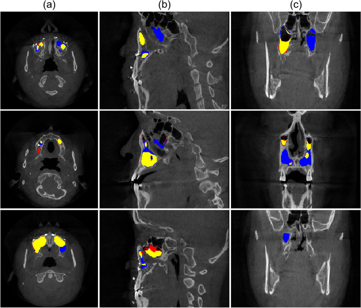 Fig. 4