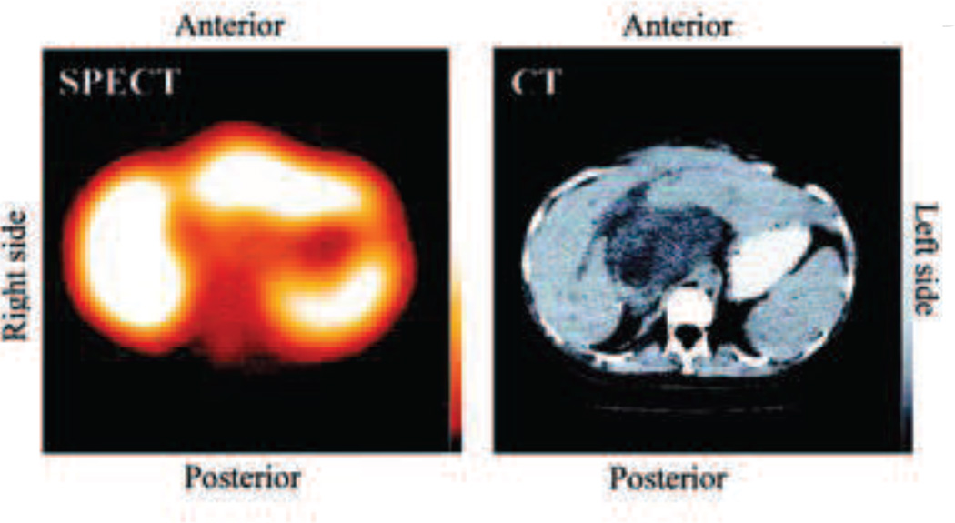 Fig. 19