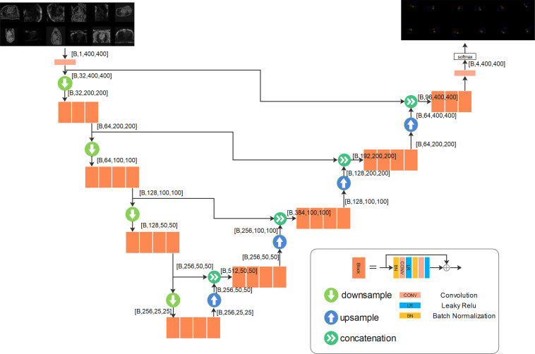 The backbone convolutional neural network developed for landmark detection has a U-Net structure. More layers can be inserted in both the downsampling branch and the upsampling branch, and more blocks can be inserted into each layer. The output layer outputs the per-pixel scores, which go through softmax function. For the landmark detection on long-axis images, data from three views were used together to train one model. As shown in the input, every minibatch was assembled by using randomly selected images from three views and was used for back propagation. A total of four layers with three or four blocks per layer were used in this experiment. The output tensor shapes were reported by using the format [B, C, H, W], where B is the size of the minibatch, and C is the number of channels, and H and W are the image height and width. Input images have one channel for image intensity, and the output has four channels for three landmarks and the background. The illustration for outputs plots three color-coded landmark channels and omits the background channel.