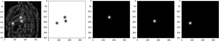 The landmark detection problem can be reformulated as a semantic segmentation problem. Every landmark point on the two-chamber image on the left can be convolved with a Gaussian kernel and converted into a spatial probability map or heatmap (upper row, from left to right: probability for background, anterior valve point, inferior valve point, and apical point). Unlike in the binary detection task in which the target is a one-hot binary mask, loss functions working on continuous probability such as the Kullback-Leibler divergence are needed.