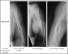 Fig 1:
