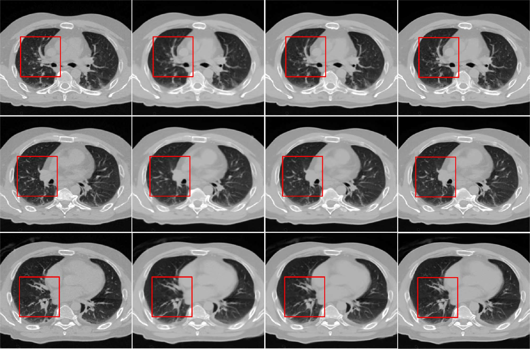 Fig. 11.