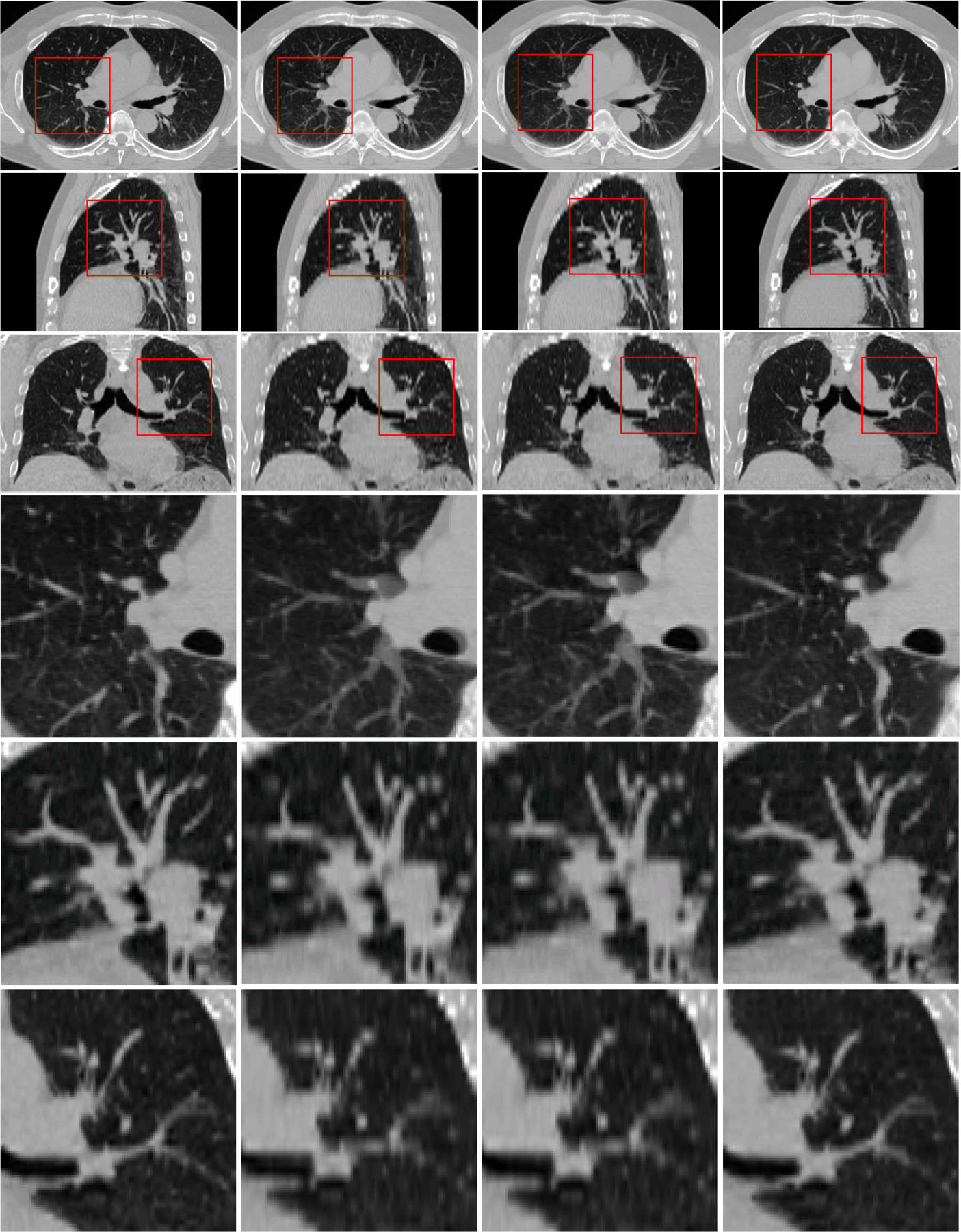 Fig. 15.