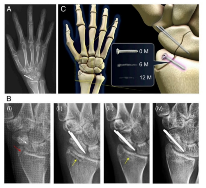 Figure 13