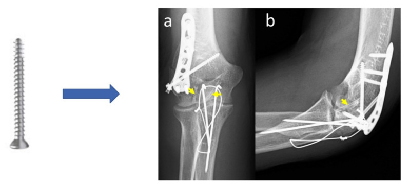 Figure 12