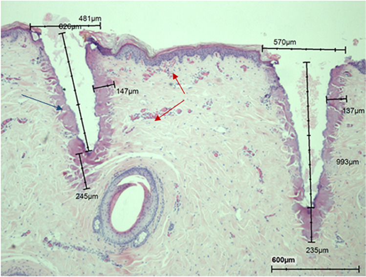 Fig. 11