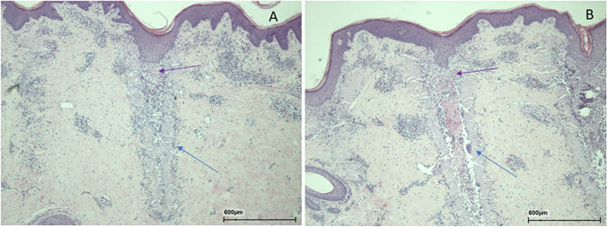 Fig. 13