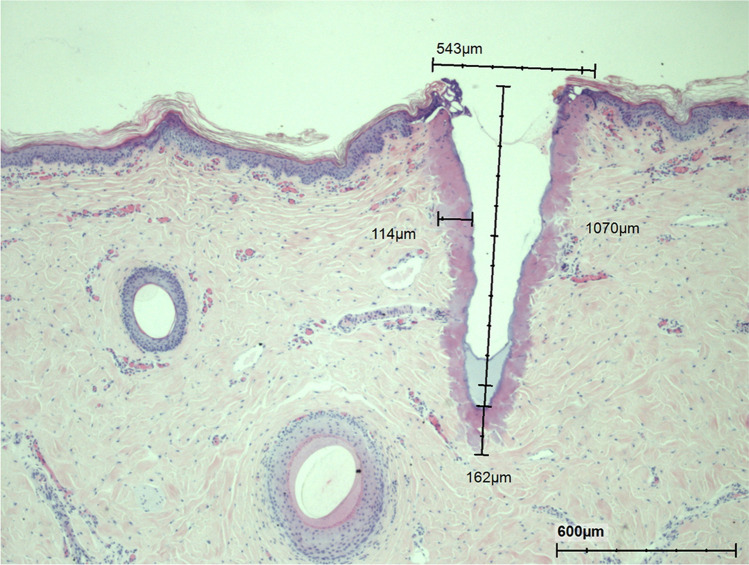 Fig. 10