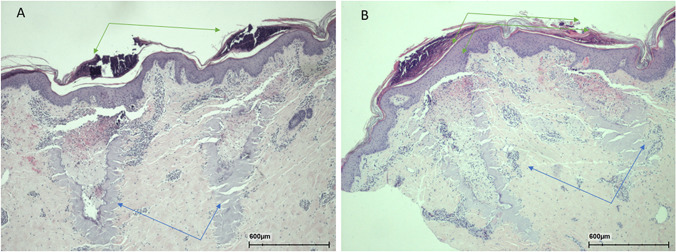 Fig. 12