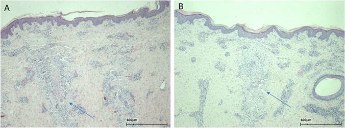 Fig. 14