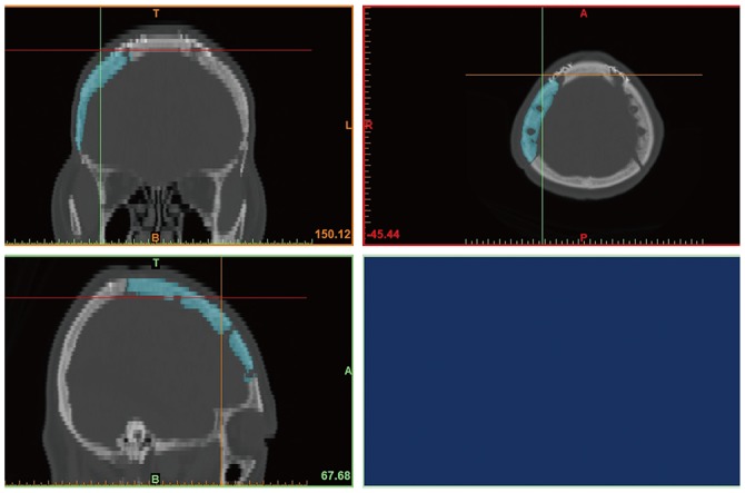 Fig. 2