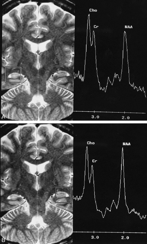 fig 4.