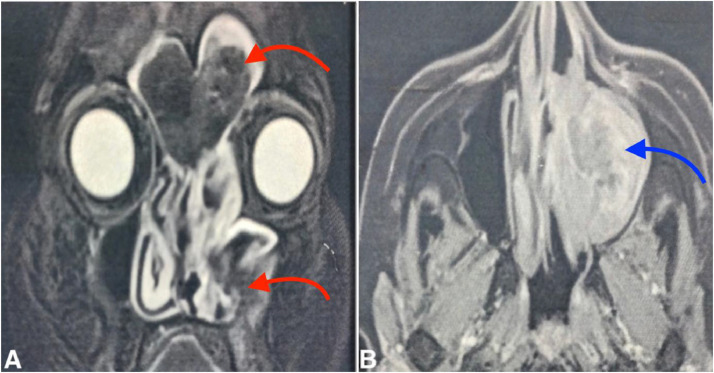 Fig 3: