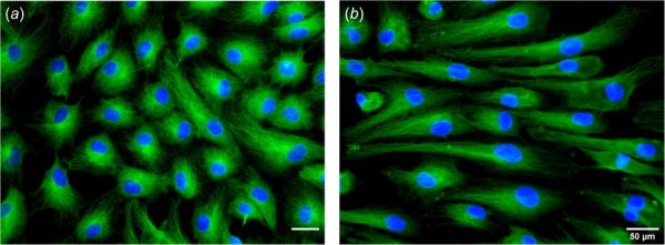 Representative images of endothelial cell morphology under static and laminar flow conditions. Immunofluorescent images are stained for microtubules and nuclei. (a) Endothelial cells under 24 h of static culture exhibit a nonaligned, cobblestone morphology. (b) Endothelial cells exposed to 24 h of 12.5 dynes/cm2 unidirectional laminar wall shear stress exhibit an aligned and elongated morphology. The flow study [14] was performed in a PPFC with dimensions of 7.62 cm × 2.54 cm × 250 μm. Fluid viscosity was 1 cP. Flow direction is horizontal. Scale bars indicate 50 μm.