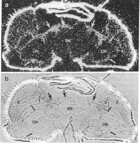 graphic file with name pnas00251-0405-b.jpg