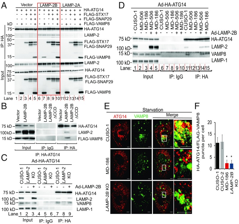 LAMP-2B regulates human cardiomyocyte function by mediating ...