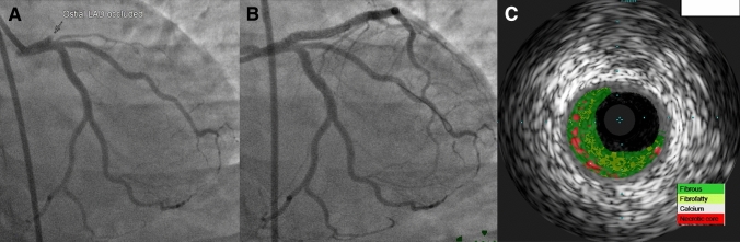 Fig. 3