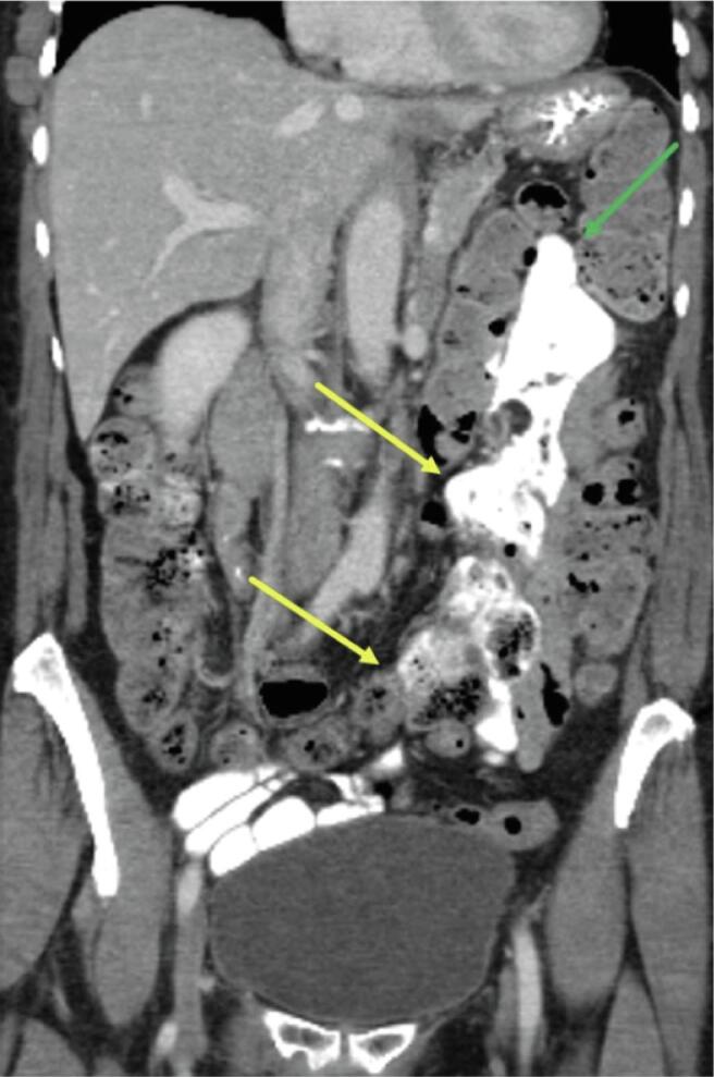 Fig. 1