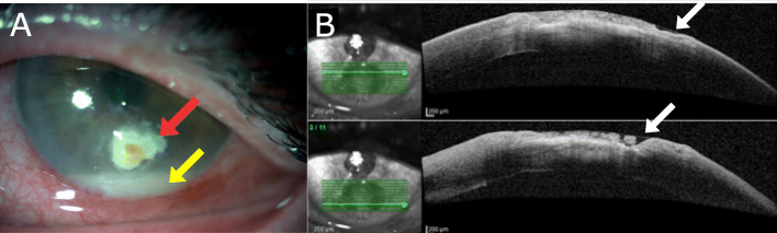 Fig. 1