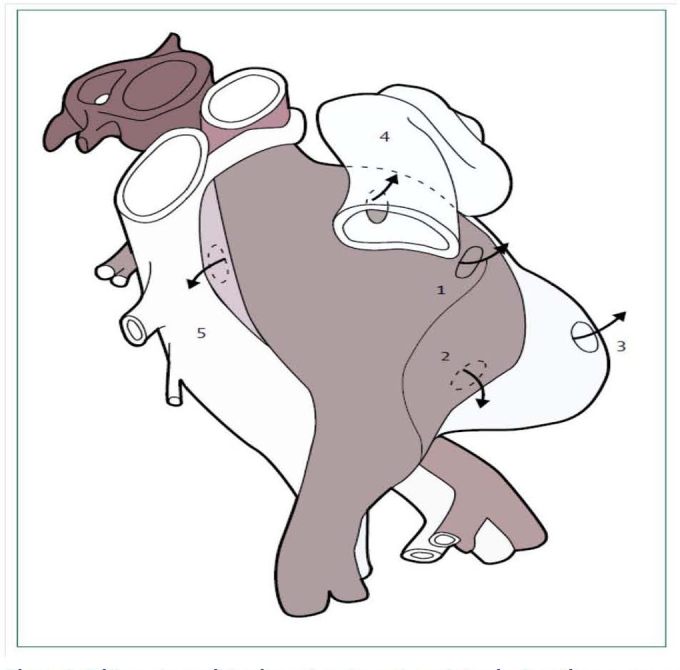 Figure. 1
