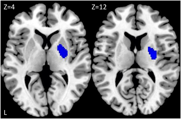 Fig. 3